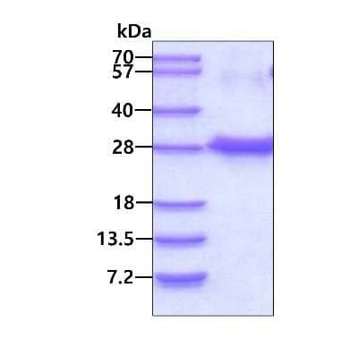 SDS-Page: Recombinant Human NUDT4 His Protein [NBP2-23304] - 3ug by SDS-PAGE under reducing condition and visualized by coomassie blue stain.